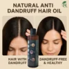 anti-dandruff-effect